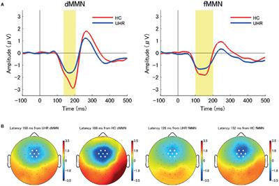Mismatch Negativity Predicts Remission and Neurocognitive Function in Individuals at Ultra-High Risk for Psychosis